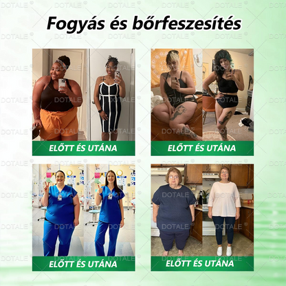 𝑴𝒆𝐭𝐚𝐛𝐨𝐥𝐢𝐤𝐮𝐬 𝑵𝒂𝐧𝐨 𝑴𝒊𝒌𝒓𝐨𝐭ú𝐬 𝑇𝑎𝒑𝐚𝐬𝐳✨ (Csak naponta egyszer használható, látható eredmények 7 napon belül!) ✅ Berenil + Moringa formuláció, ideális tömegtúlzsúlláshoz, bőrhiányossághoz, cukorbetegséghez, apnához és ízületi problémákhoz 💥